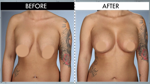 Does garcinia cambogia at walmart work image 1